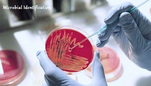 Microbial Identification Industry